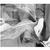 3M Steri-Drape Arthroscopy Drapes  Pack