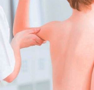 Muscular Dystrophy