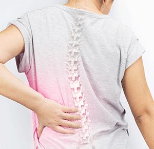 Scoliosis