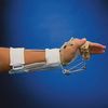Rolyan Adjustable Outrigger Kit for MCP Flexion