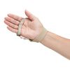 Deviation Splint