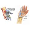 Carpal Tunnel Syndrome