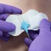 Tidi Grip Lok CVC Securement Device - 2 Step Of Application