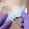 Tidi Grip Lok CVC Securement Device - 4 Step Of Application