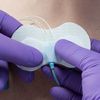 Tidi Grip Lok CVC Securement Device - 3 Step Of Application